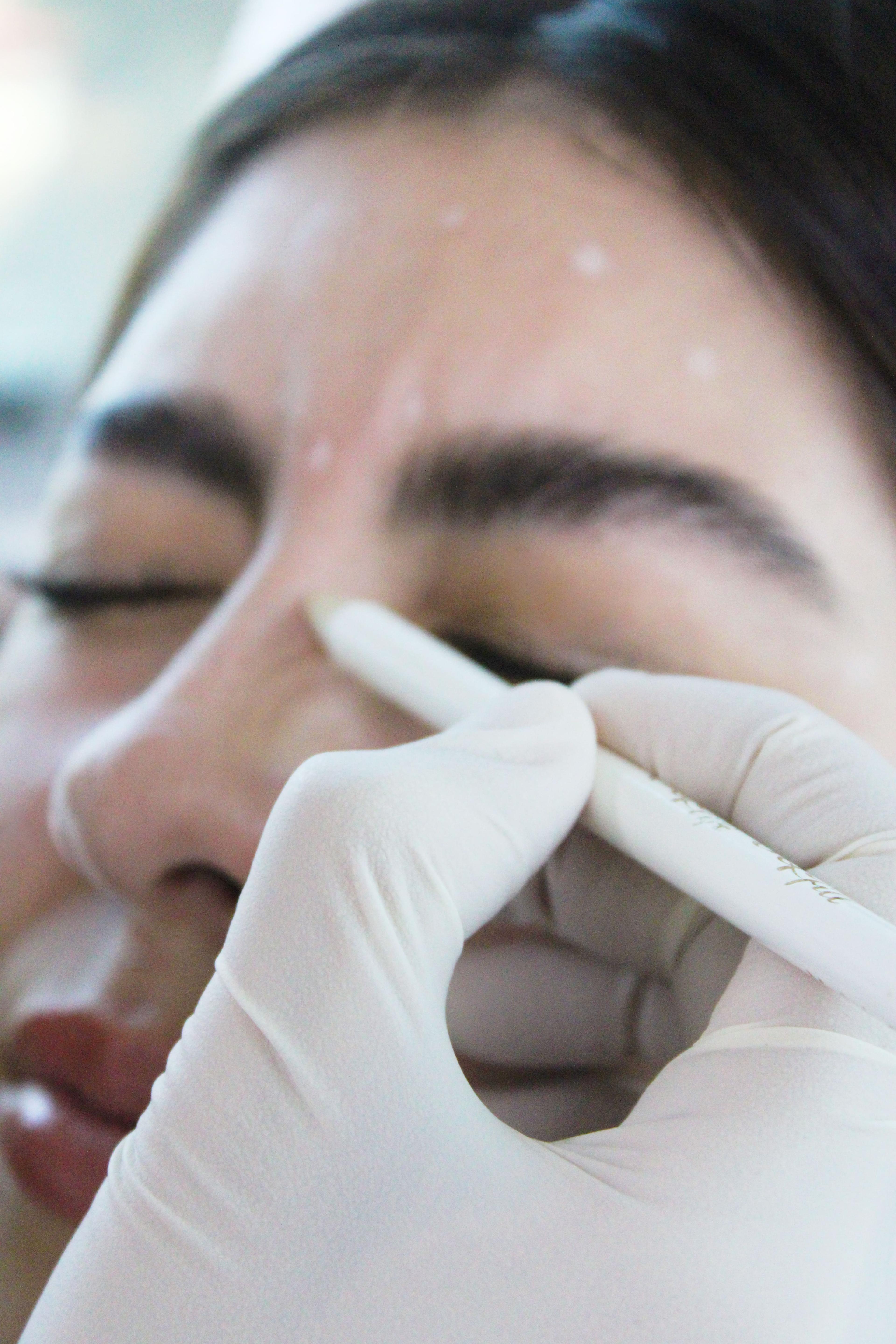 Facial treatments